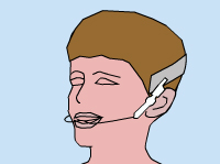 orthodontic headgear